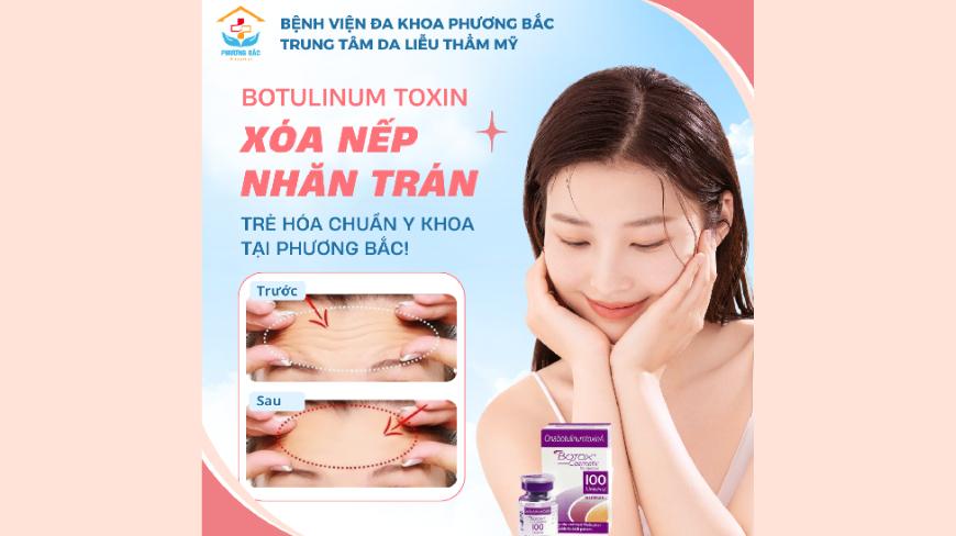 XÓA NẾP NHĂN TRÁN - TRẺ HÓA CHUẨN Y KHOA TẠI PHƯƠNG BẮC!