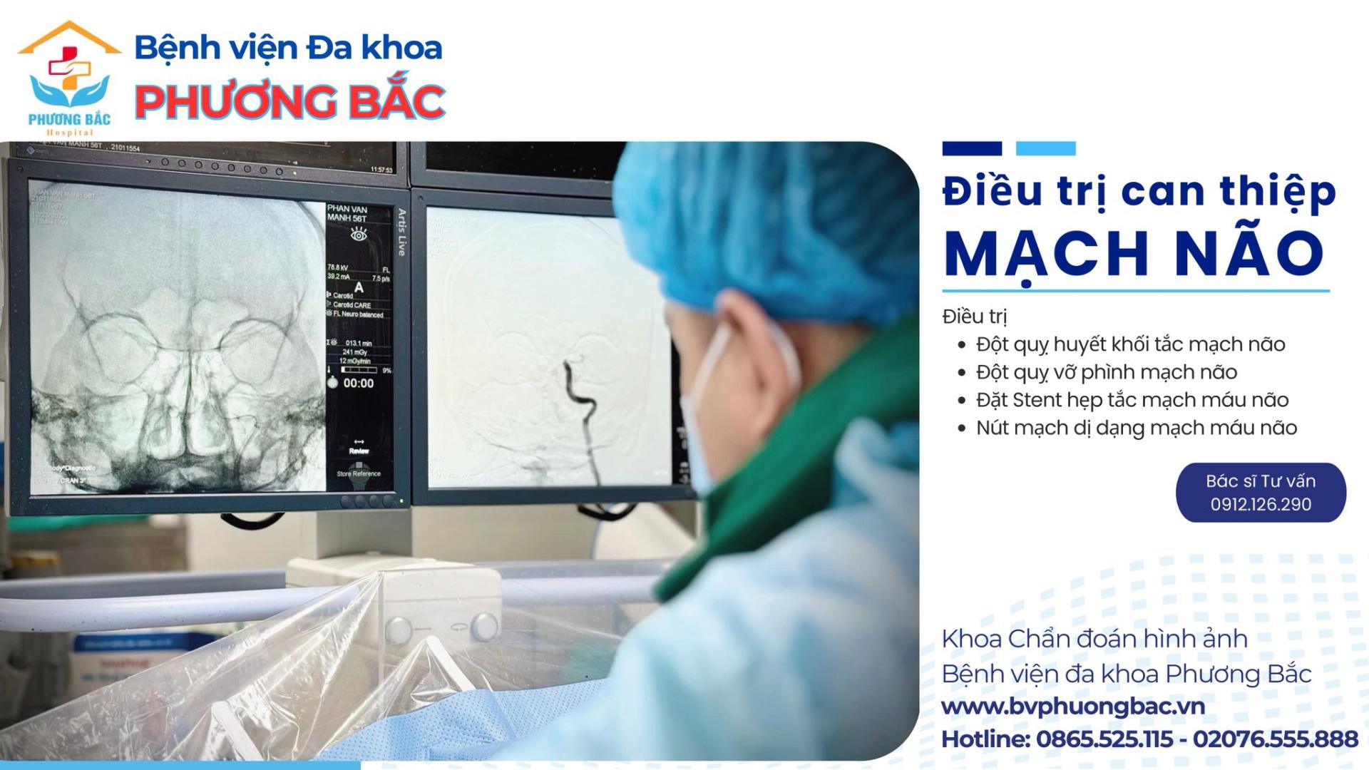 CAN THIỆP MẠCH NÃO - GIẢI PHÁP ĐIỀU TRỊ HIỆN ĐẠI, GIÀNH LẠI “THỜI GIAN VÀNG” CHO NGƯỜI BỆNH