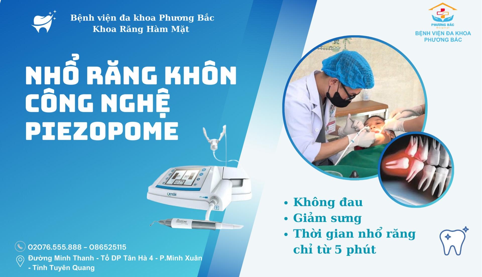 NHỔ RĂNG BẰNG MÁY – GIẢI PHÁP ÊM ÁI CHO NỤ CƯỜI KHỎE MẠNH!