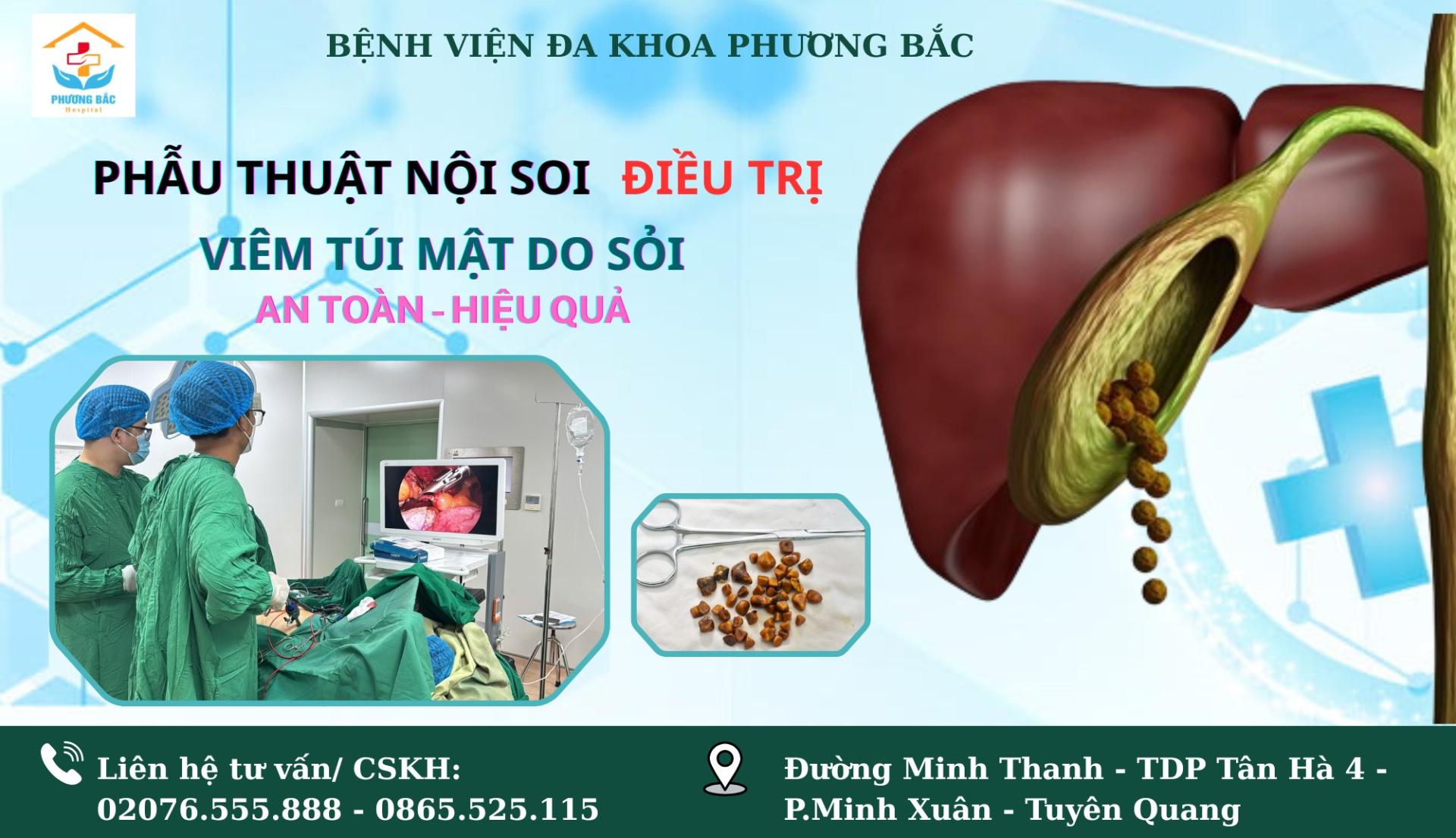 TÁN SỎI MẬT QUA DA BẰNG CÔNG NGHỆ LASER TẠI BVĐK PHƯƠNG BẮC