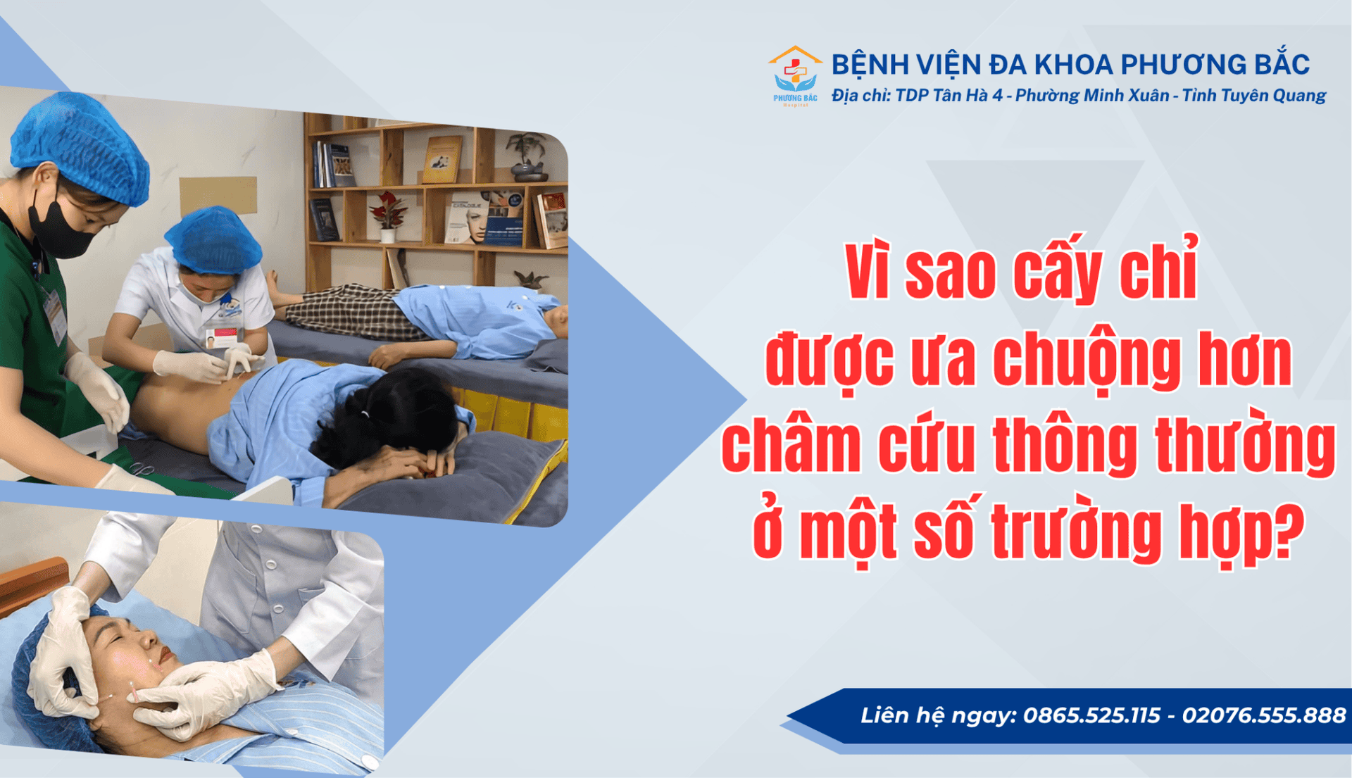 VÌ SAO CẤY CHỈ ĐƯỢC ƯA CHUỘNG HƠN CHÂM CỨU Ở MỘT SỐ TRƯỜNG HỢP?