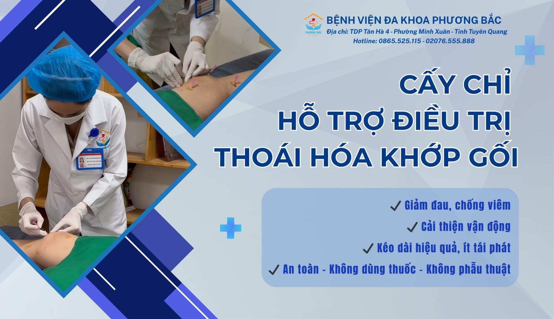 CẤY CHỈ HỖ TRỢ ĐIỀU TRỊ THOÁI HÓA KHỚP GỐI – GIẢM ĐAU, CẢI THIỆN VẬN ĐỘNG THẾ NÀO?