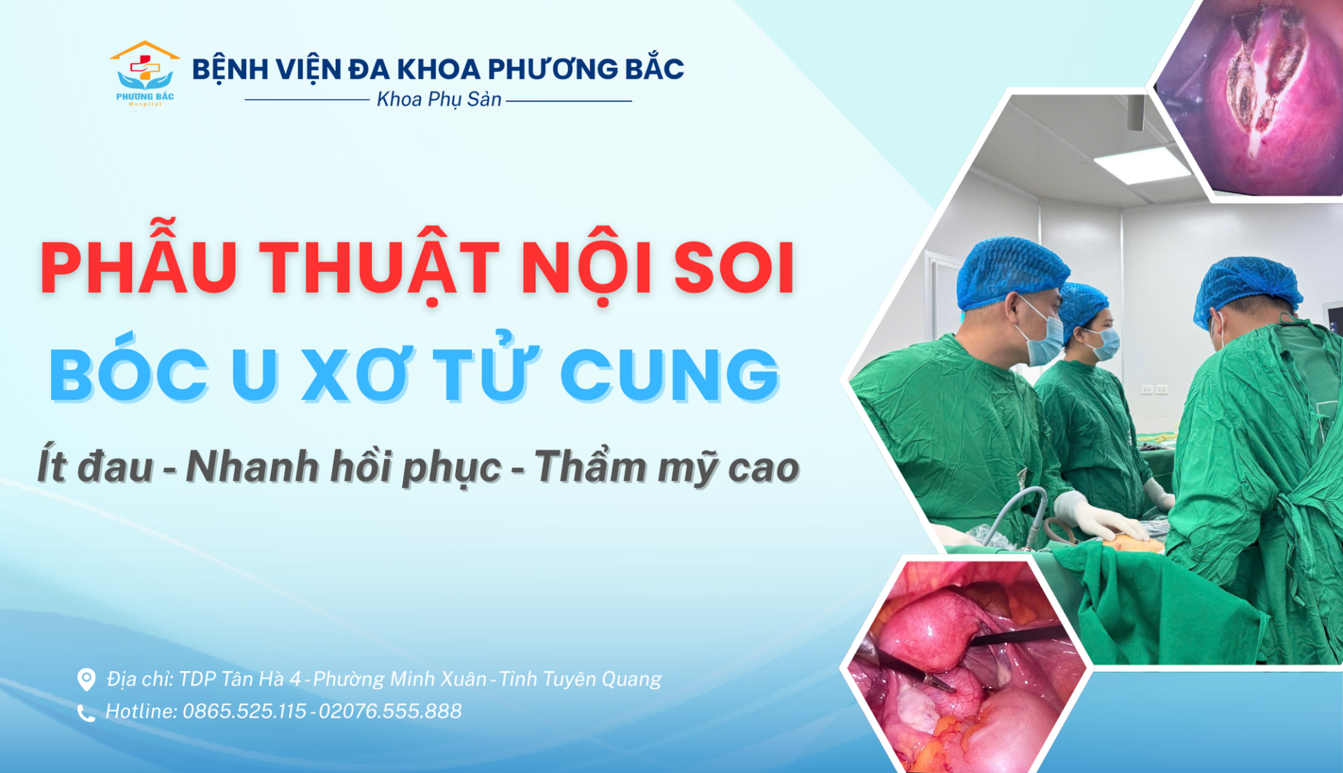 PHẪU THUẬT NỘI SOI BÓC U XƠ TỬ CUNG - ÍT ĐAU, NHANH PHỤC HỒI, HIỆU QUẢ CAO
