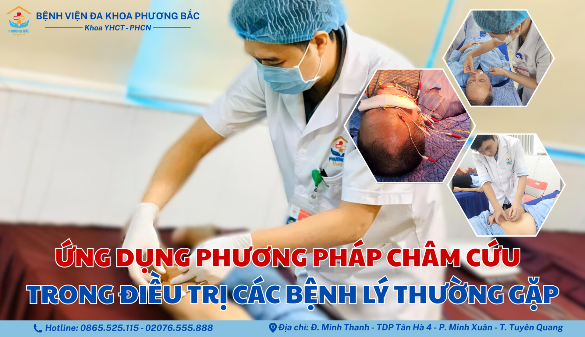 ỨNG DỤNG PHƯƠNG PHÁP CHÂM CỨU TRONG ĐIỀU TRỊ BỆNH LÝ THƯỜNG GẶP
