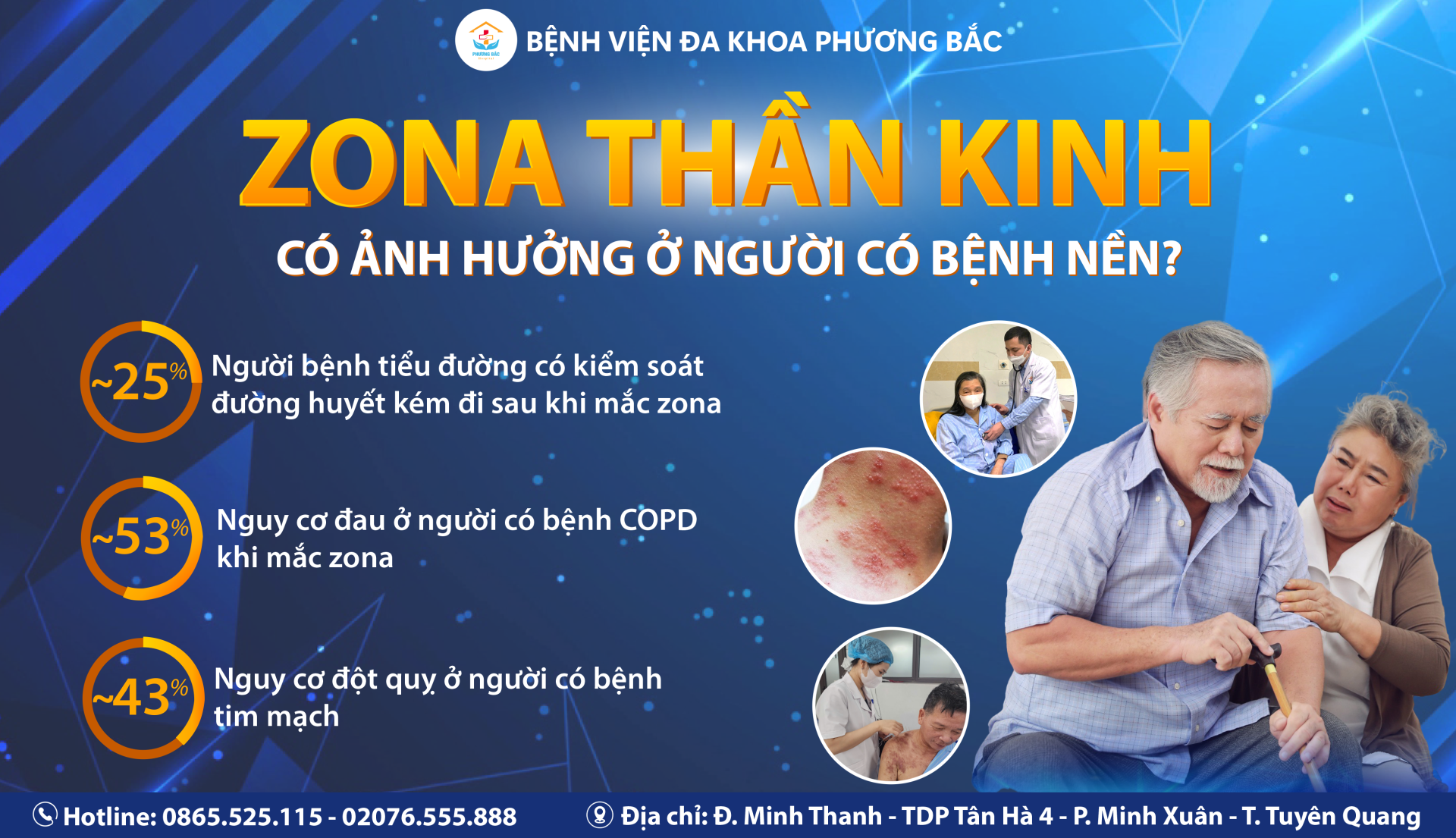 ZONA THẦN KINH – NGUY HIỂM HƠN Ở NGƯỜI CÓ BỆNH NỀN