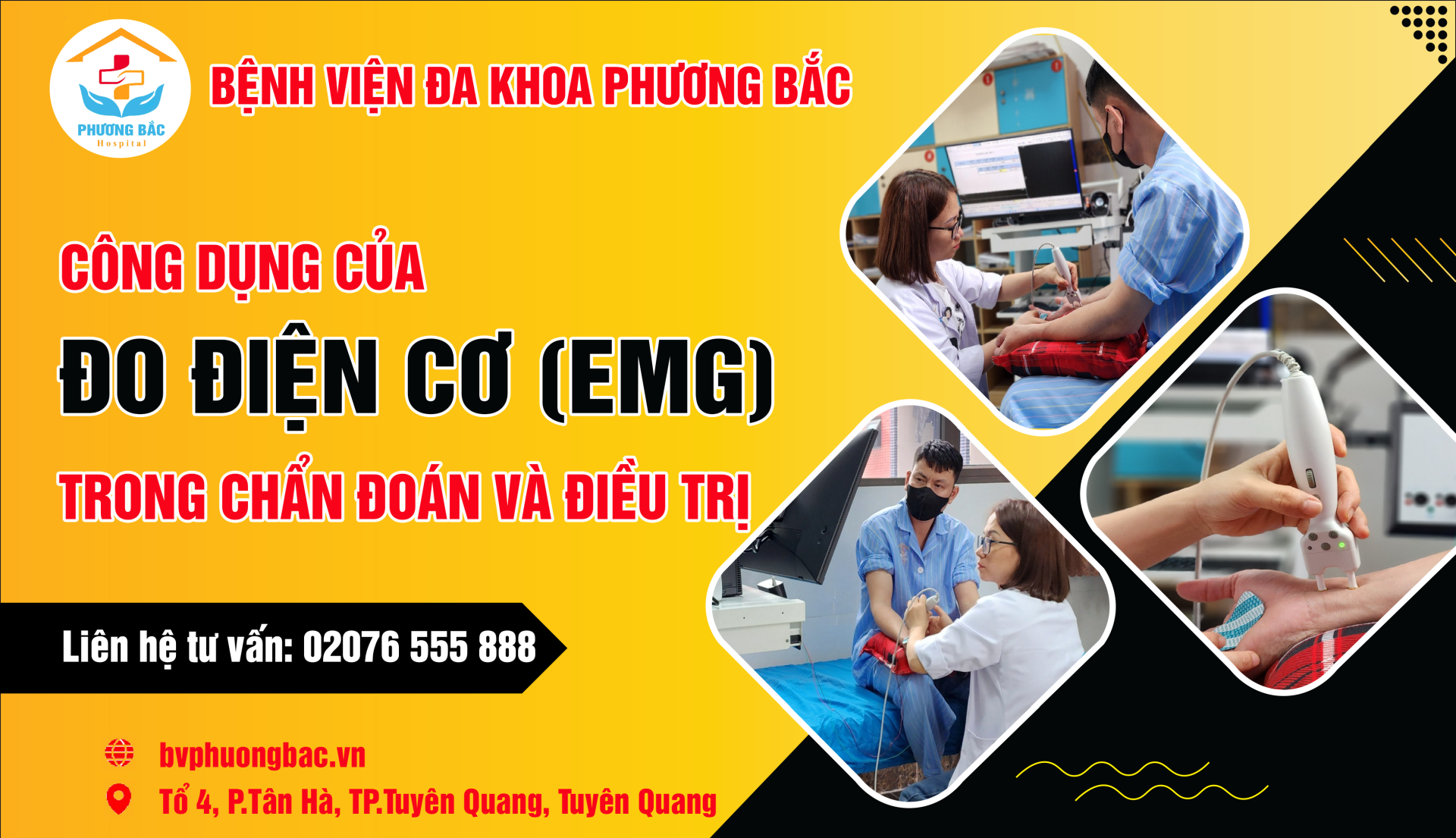 Đo Điện Cơ (EMG) – Bóc Trần Sự Thật Về Những Cơn Tê Bì, Yếu Cơ Khó Chịu!