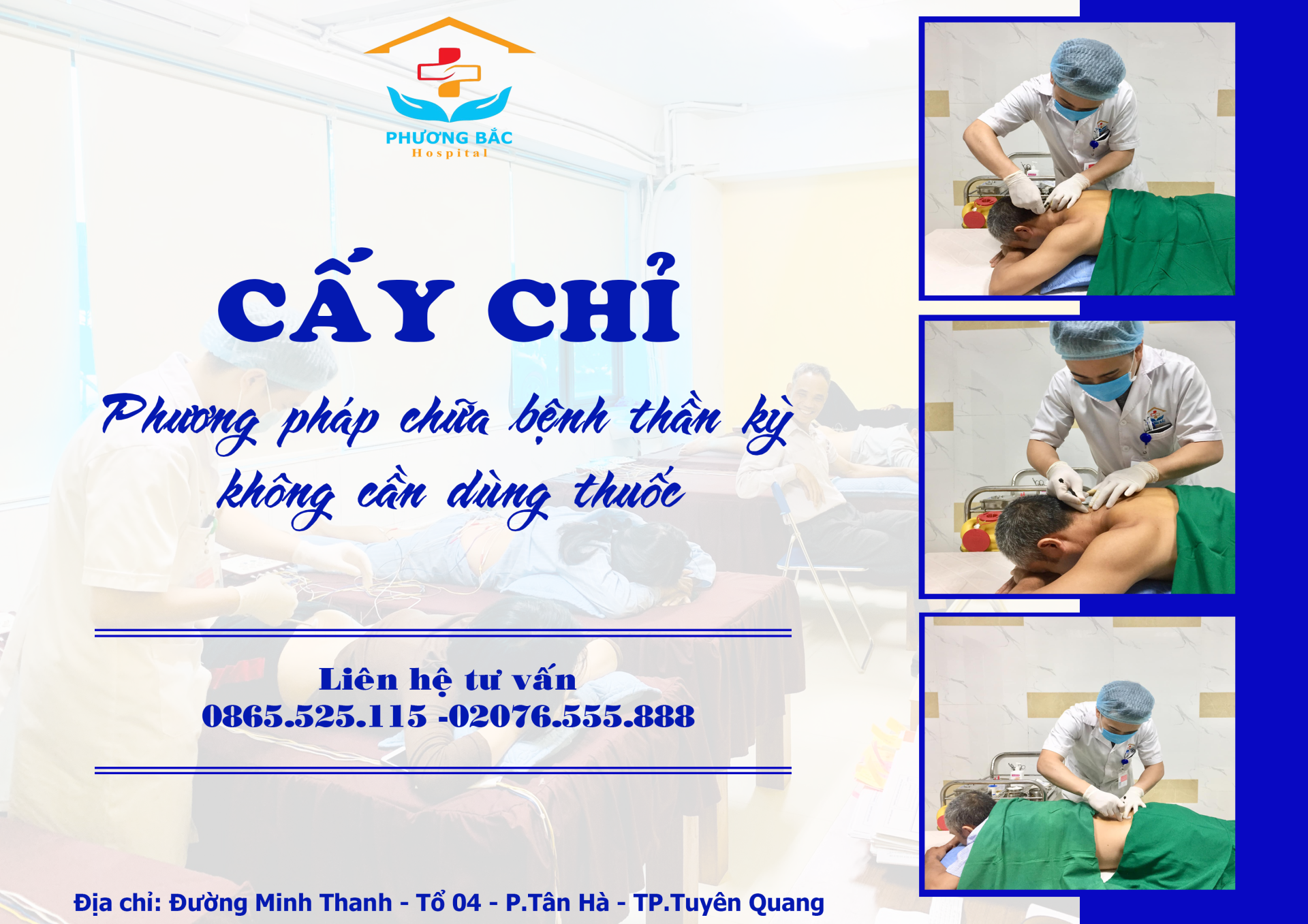 "Cấy chỉ" phương pháp chữa bệnh thần kỳ không cần dùng thuốc