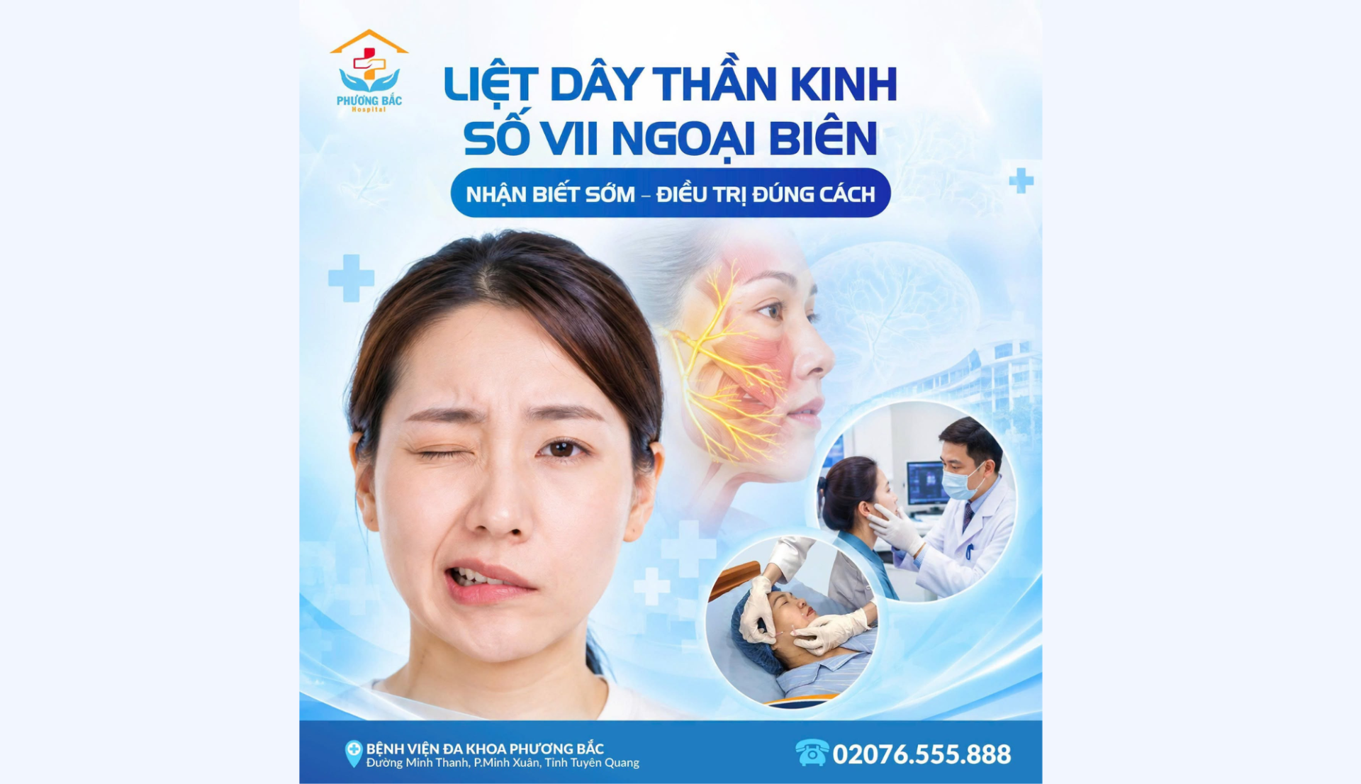 LIỆT DÂY THẦN KINH SỐ VII NGOẠI BIÊN: NHẬN BIẾT SỚM – ĐIỀU TRỊ ĐÚNG CÁCH