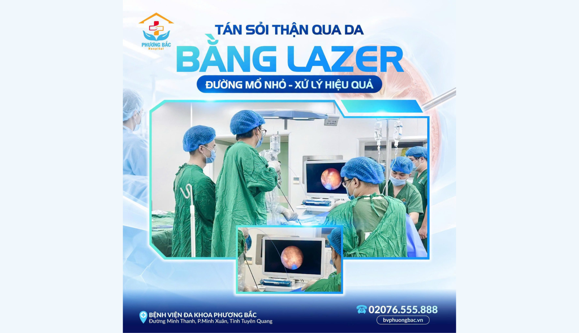 TÁN SỎI THẬN QUA DA BẰNG LASER – ĐƯỜNG MỔ NHỎ, XỬ LÝ SỎI HIỆU QUẢ