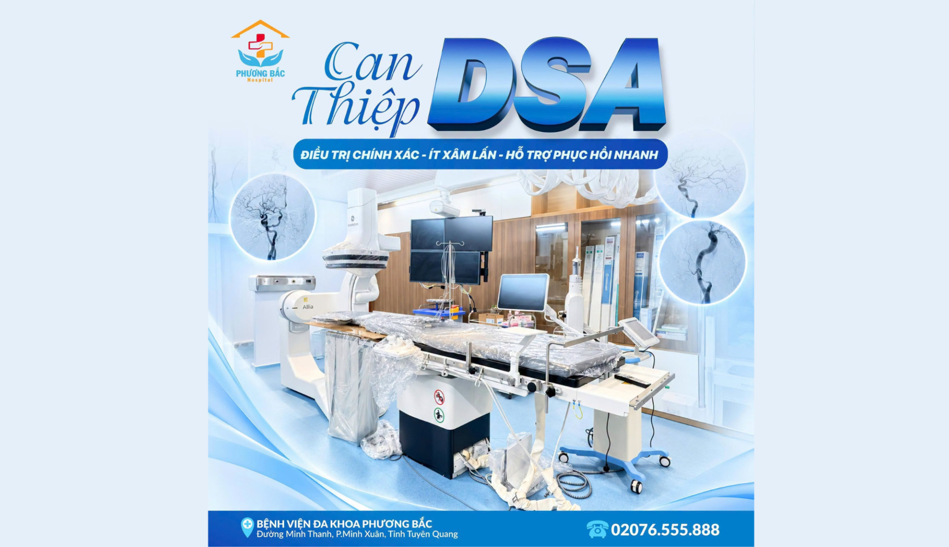 CAN THIỆP DSA – ĐIỀU TRỊ CHÍNH XÁC, ÍT XÂM LẤN, HỖ TRỢ PHỤC HỒI NHANH