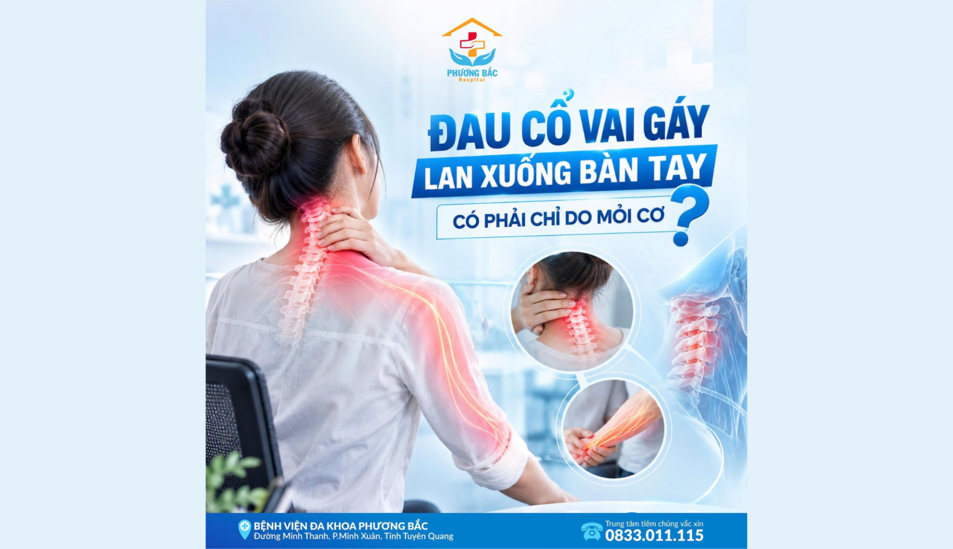 ĐAU CỔ VAI GÁY LAN XUỐNG BÀN TAY – CÓ PHẢI CHỈ DO MỎI CƠ?